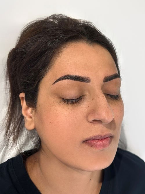 After cosmetic tattoo Vaughan