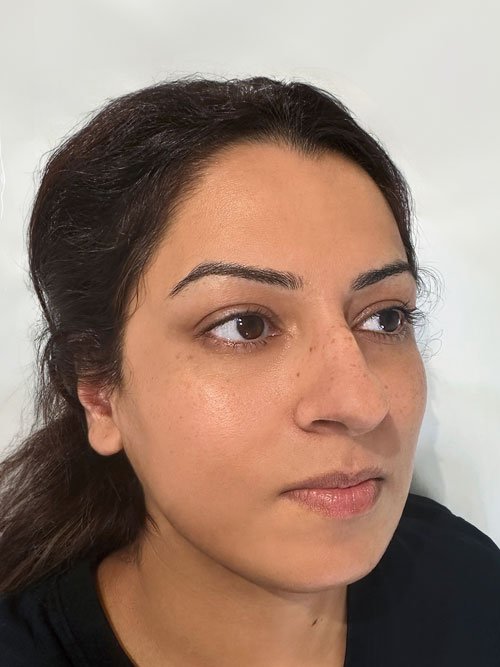 Before cosmetic tattoo Vaughan